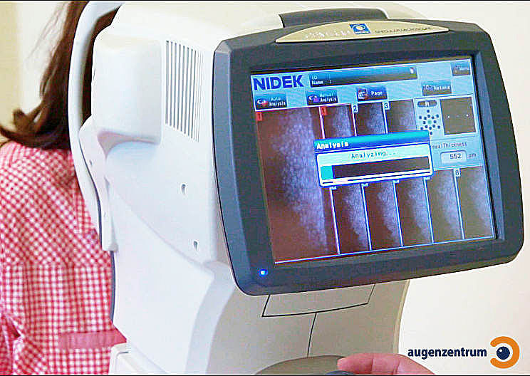 Endothelmikroskop beim Messen - Mit einer hochpräzisen, computergestützten Spezialkamera wird die Anzahl der Endothelzellen der Hornhaut analysiert.
